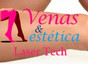 Venas y Estética