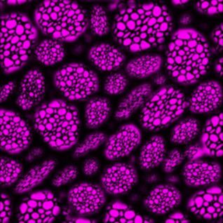 imagen microscópica de los biopolímeros