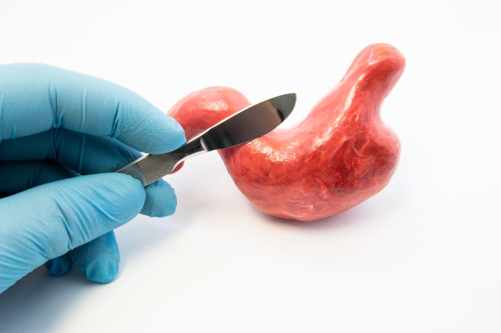 Cirujano sosteniendo bisturí cerca del modelo anatómico del estómago