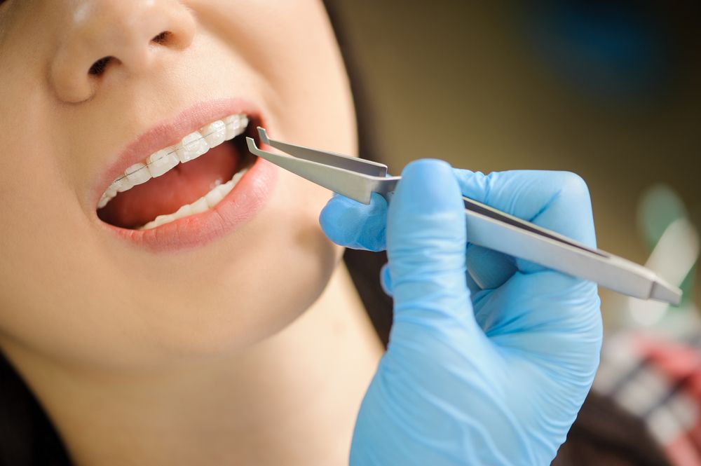 médico revisa ortodoncia de una paciente