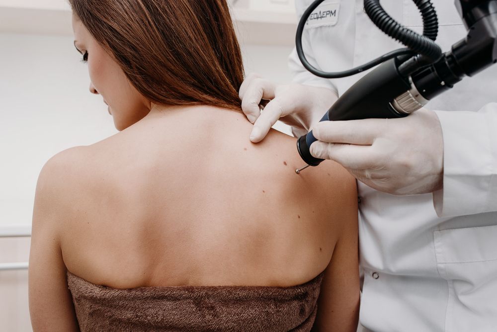 Mujer recibe terapia para borrar marcas en la piel