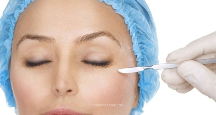 Prepárate para una blefaroplastia: consejos para tu operación