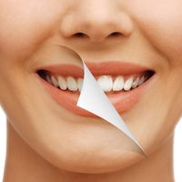Los tres tipos de blanqueamiento dental más usados en Colombia
