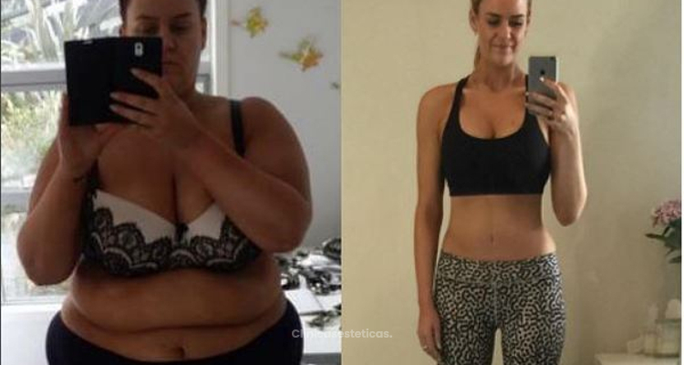 La experiencia de Simone Anderson 88 kilos en 20 meses