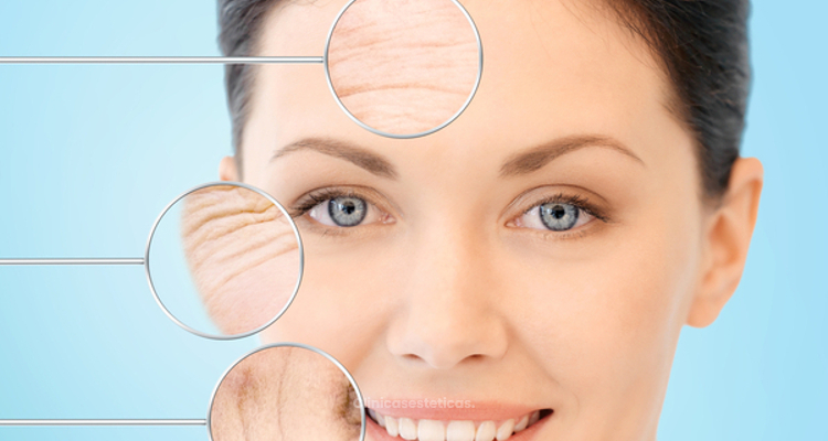 Skin needling: la aguja que mejora nuestra piel