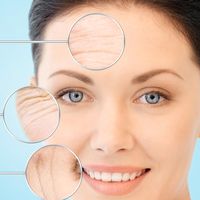 Skin needling: la aguja que mejora nuestra piel