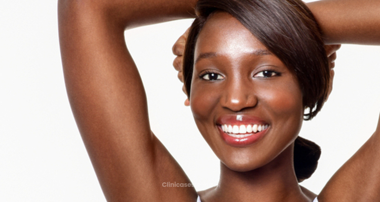 ​Consejos para cuidar la piel afro