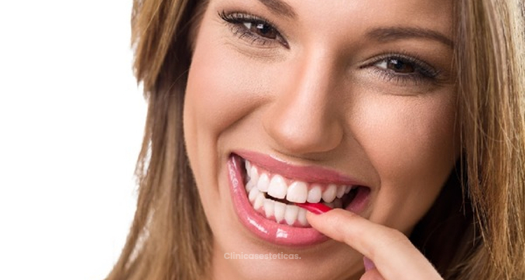 Dientes más blancos con la dieta blanca