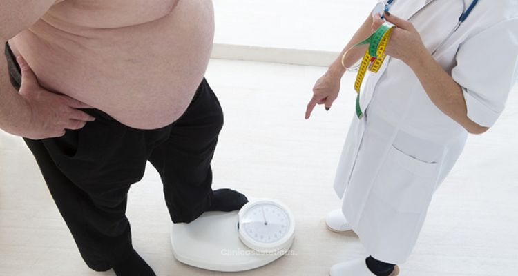 ¿Existen diferentes tipos de obesidad?