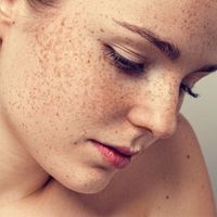Métodos para eliminar las manchas en la piel