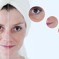 Bioplastia: un tratamiento para rejuvencer