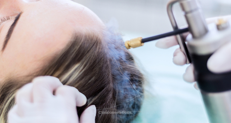 Crioterapia: una forma de reducir la caída del cabello después de una quimioterapia