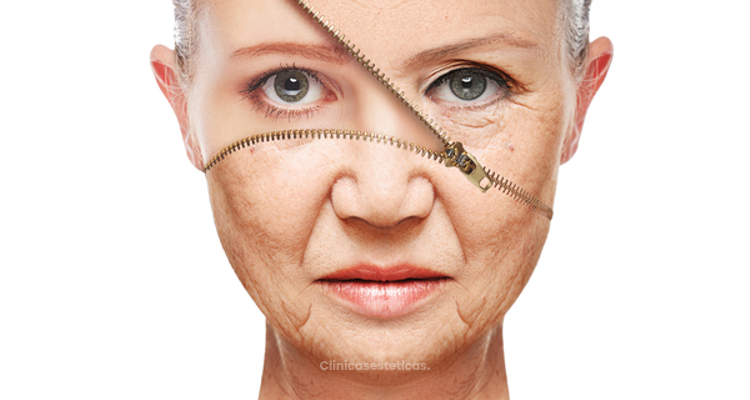 Blanchig: un método eficaz para eliminar las arrugas
