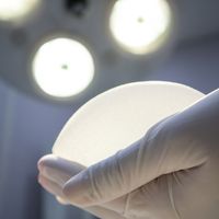 Mamoplastia secundaria: la importancia de los implantes de poliuretano