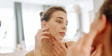 ¿Sabías que existe más de un tipo de acné?