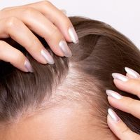 Tratamientos para el cabello