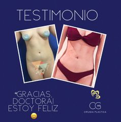 Liposucción - Dra. Catalina Guzman Duque