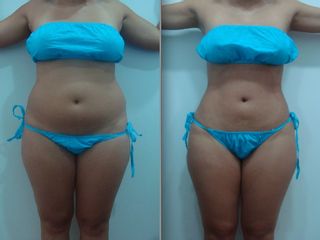 ZAHIA Centro de Medicina Estética