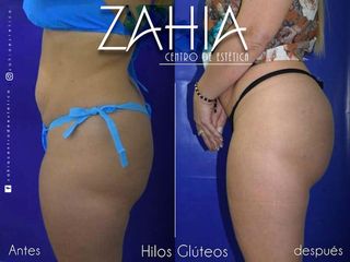 ZAHIA Centro de Medicina Estética 
