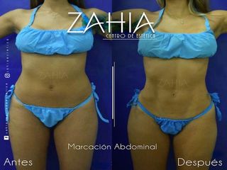 ZAHIA Centro de Medicina Estética 