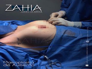 ZAHIA Centro de Medicina Estética 