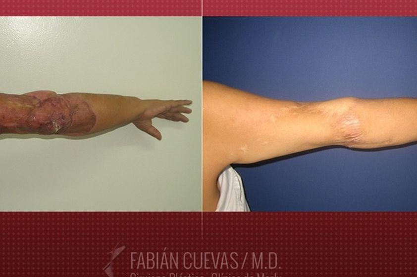 Cirugía reconstructiva antes y después - 580223