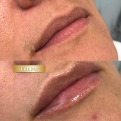 LABIOS - Dra. Konny Aldana