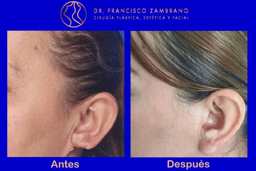 Cirugía reconstructiva antes y después - 661416