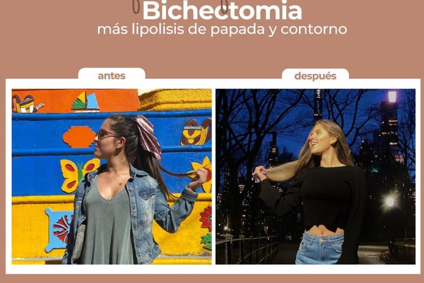 Rejuvenecimiento facial antes y después - 820822