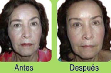 Cirugía Estética Facial