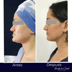Cirugía maxilofacial - Dr. Andrés Felipe Revelo Salamanca