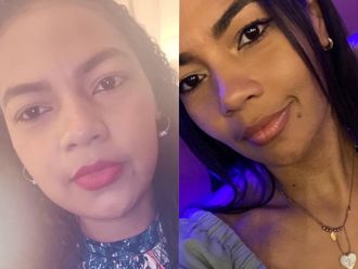 Bichectomía antes y después - 848309