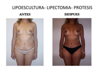 Dr. Castilla