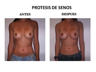 Dr. Castilla