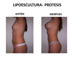 Dr. Castilla