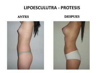 Dr. Castilla