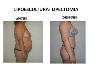 Dr. Castilla