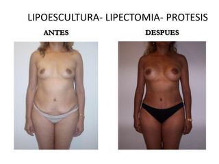 Dr. Castilla