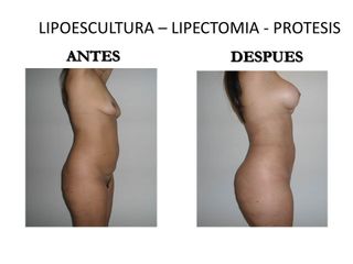 Dr. Castilla