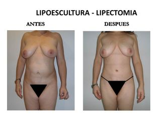 Dr. Castilla