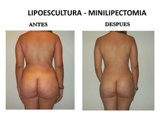 Dr. Castilla