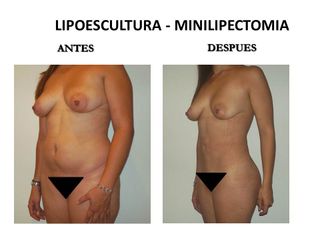 Dr. Castilla