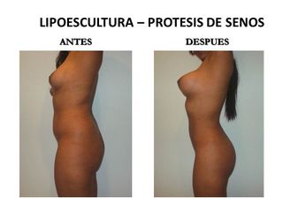 Dr. Castilla
