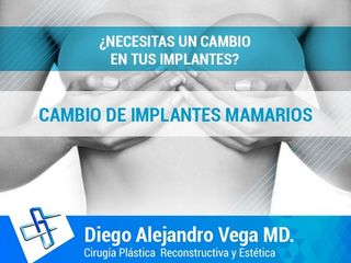 cambio de implantes