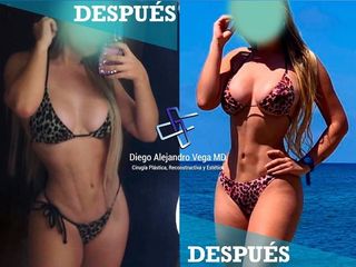 LIPO 4D