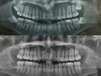 Cirugía maxilofacial - 621429