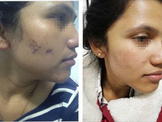 Manchas en la piel - 635832