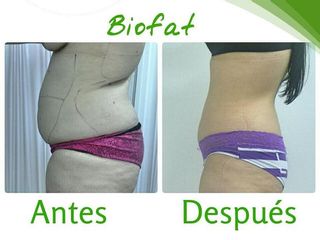 Antes y despues de biofat