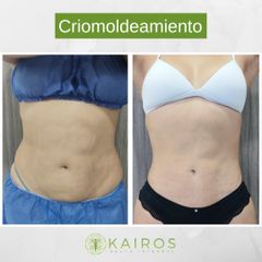 Kairos Salud Integral