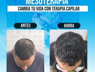 Tratamientos para el cabello antes y después - 871196